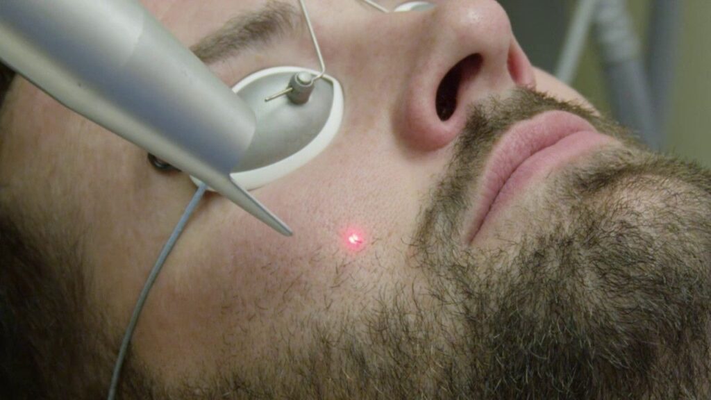 laser skin treatment
